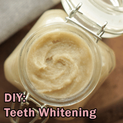 DIY: Teeth Whitening