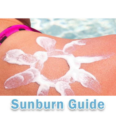 Sunburn Guide 2.0
